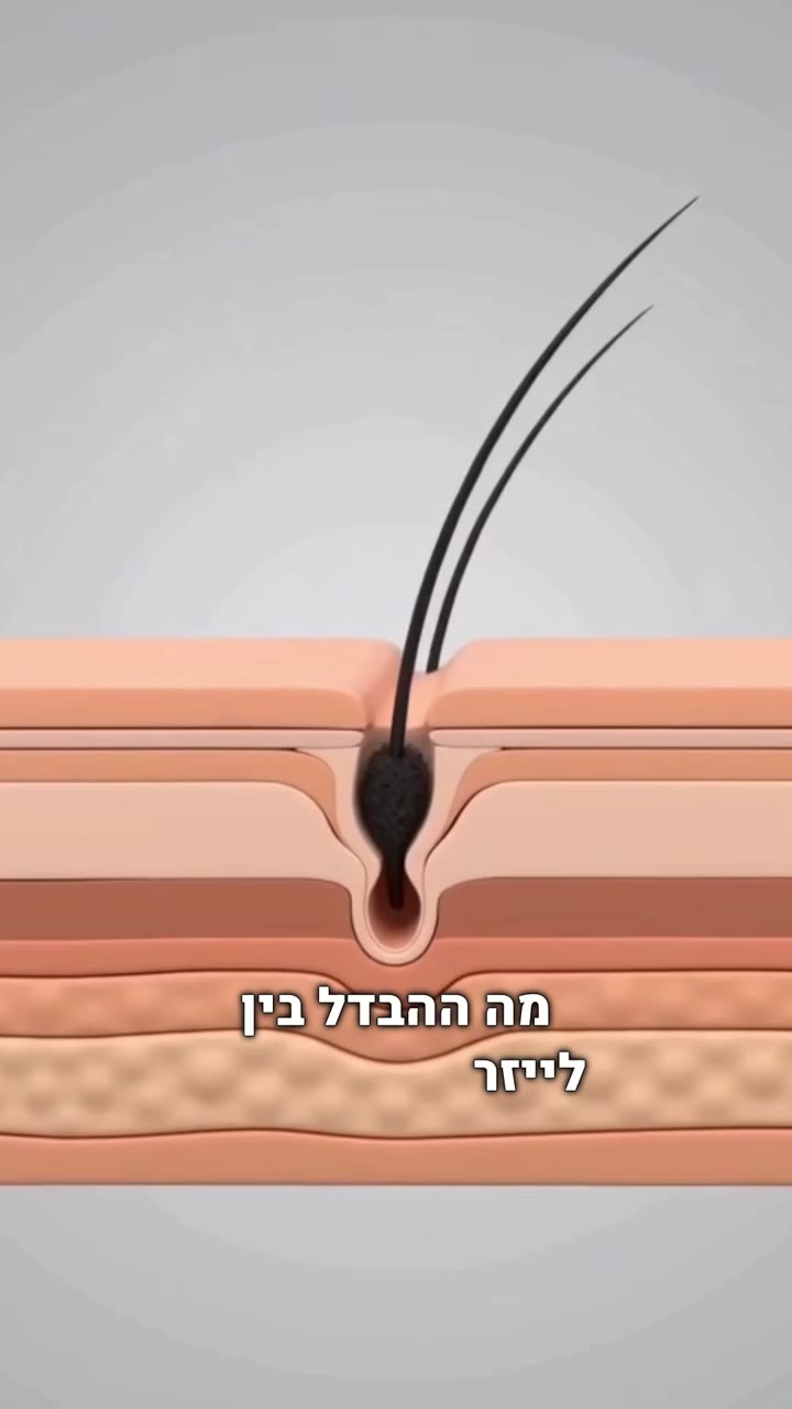 רילס ללקוח